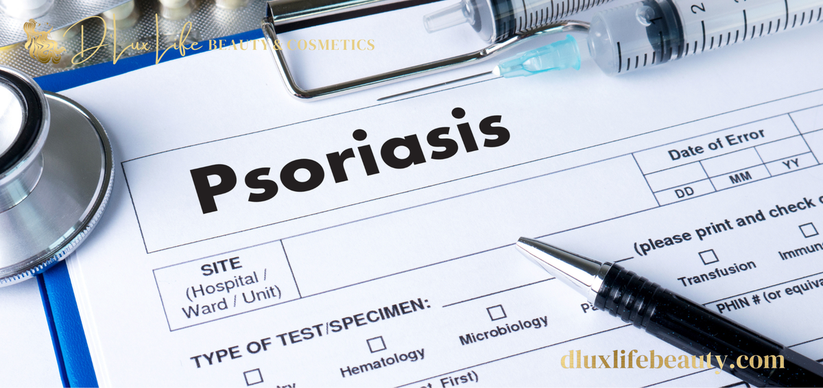 Psoriasis and Skincare: How to Care for Dry, Sensitive Skin Every Day