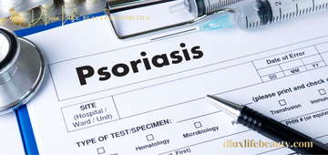 Psoriasis and Skincare: How to Care for Dry, Sensitive Skin Every Day